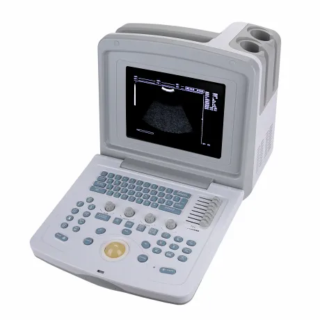 УЗИ сканер Med-Mos CMS600B3 Код товара: 00793 - Фото 29