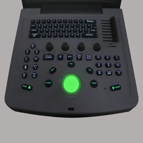 УЗИ сканер Med-Mos CMS600B3 Код товара: 00793 - Фото 20