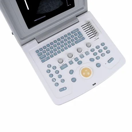 УЗИ сканер Med-Mos CMS600B3 Код товара: 00793 - Фото 28
